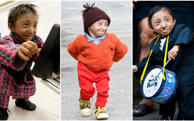 Magar, chàng trai lùn nhất thế giới, qua đời ở tuổi 27 Ảnh 2