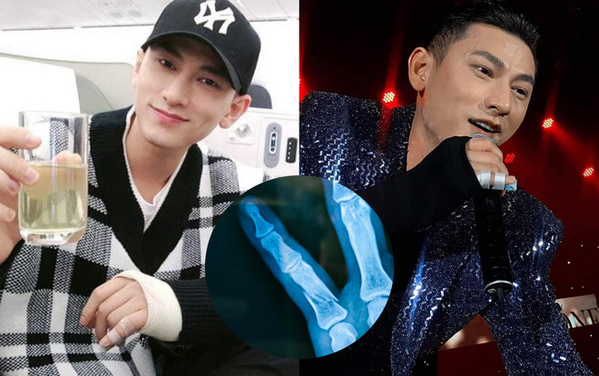 Isaac giấu fan chuyện xương tay gãy đôi, vẫn chăm chỉ đi diễn đến 26 Tết Ảnh 2