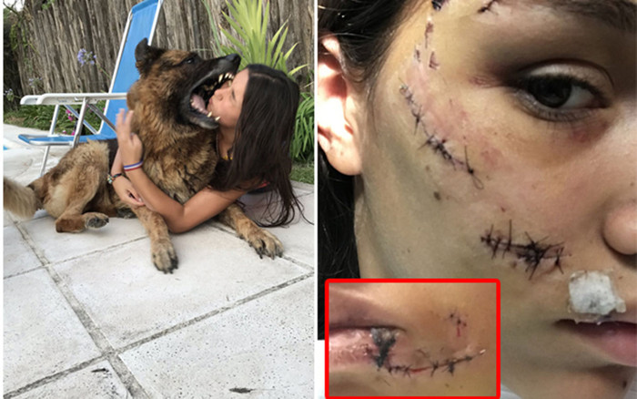 Cô gái phải khâu 40 mũi trên mặt vì chụp ảnh cùng chó cưng Ảnh 2