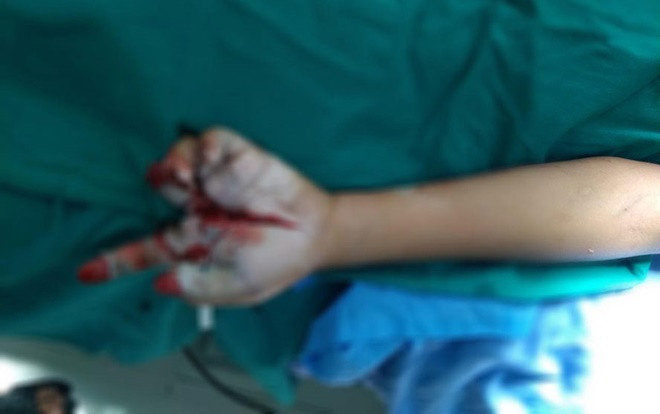 Bé trai 11 tuổi bị thương nặng do pháo nổ ngày cận Tết Ảnh 2