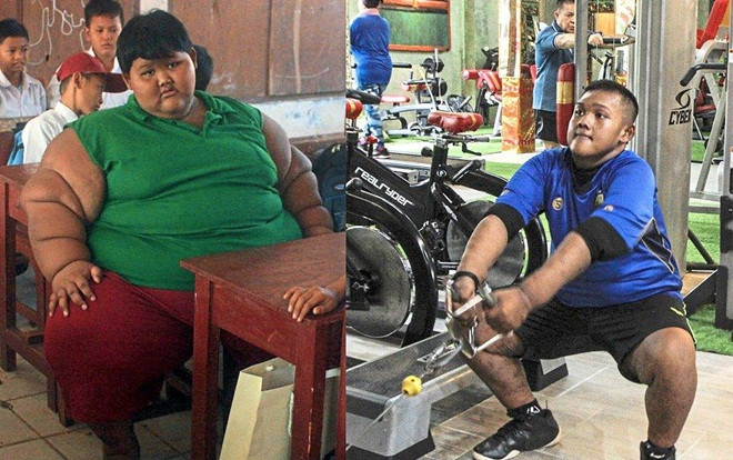 'Đứa trẻ béo nhất thế giới' giảm 100 kg trong hơn 3 năm Ảnh 2