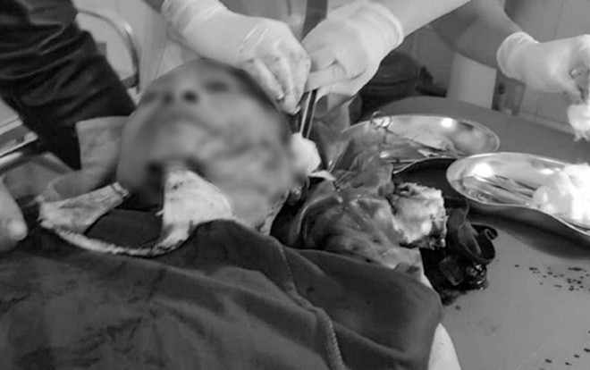 Nghệ An: Công an viên xã bị nhóm đối tượng chém trọng thương Ảnh 2