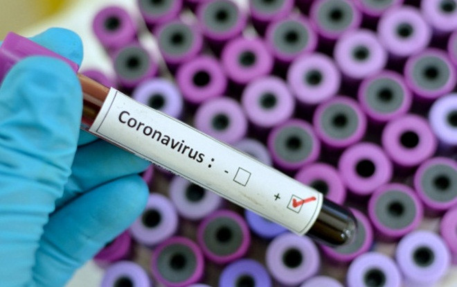 Bệnh nhân thứ 9 tại Việt Nam nhiễm virus corona Ảnh 2