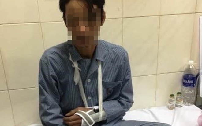 Nghi ngờ cần gạt nước mưa ô tô của mình bị trộm, nam thanh niên cầm điếu cày đánh nhân viên môi trường gãy tay Ảnh 2