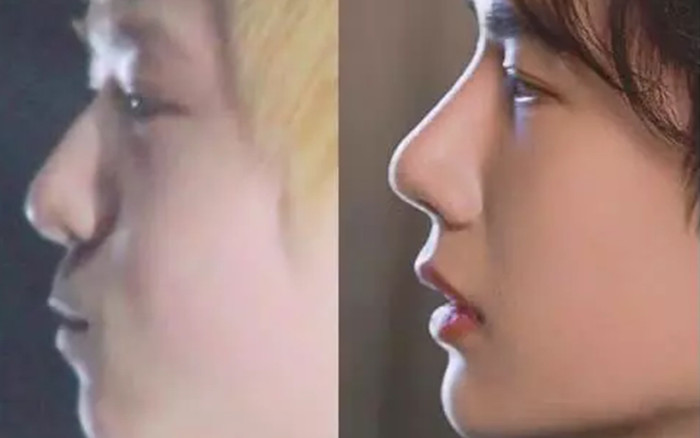 Hình ảnh quá khứ 'một trời một vực' khiến Vương Nhất Bác bị nghi ngờ phẫu thuật thẩm mỹ Ảnh 2