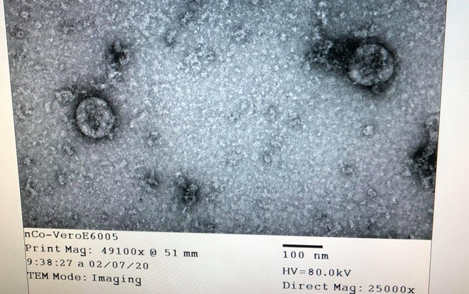 Việt Nam nuôi cấy và phân lập thành công virus corona mới Ảnh 2
