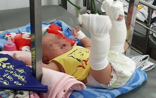 Bắt giam cha ruột bạo hành con trai 4 tháng tuổi đến xuất huyết não, gãy chân ở Sài Gòn Ảnh 2