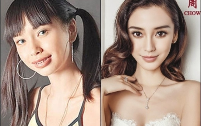 Angela Baby liên tục phủ nhận nghi vấn 'đụng chạm dao kéo' và khẳng định nhan sắc thay đổi nhiều như vậy là do…niềng răng Ảnh 2