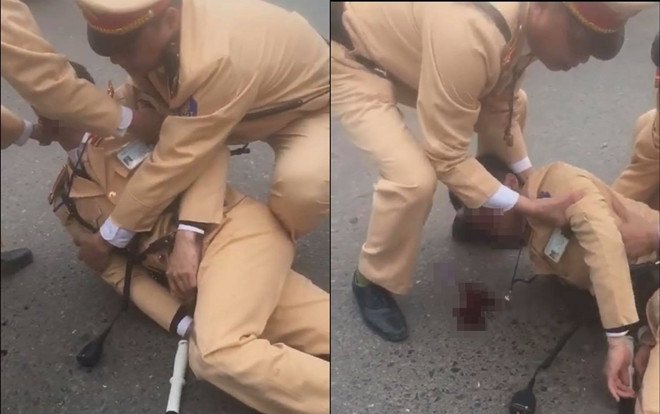 Đôi nam nữ điều khiển xe máy tông gục trung uý CSGT bất tỉnh trên đường Ảnh 2