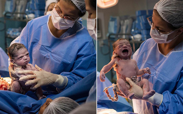 Bé gái vừa chào đời đã 'lườm' bác sĩ tóe lửa gây sốt mạng xã hội Ảnh 2