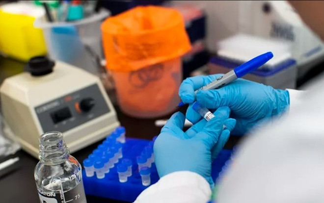 Người đàn ông đột tử trong nhà trọ ở Hà Nội âm tính với COVID-19 Ảnh 2