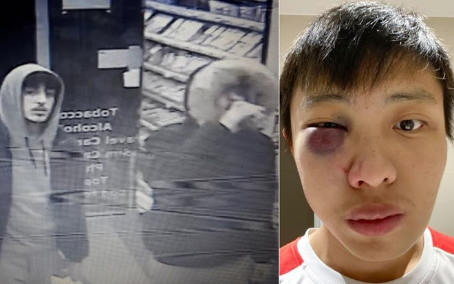 Hé lộ hình ảnh 4 kẻ đánh sinh viên châu Á đến gãy xương mặt vì COVID-19 Ảnh 2