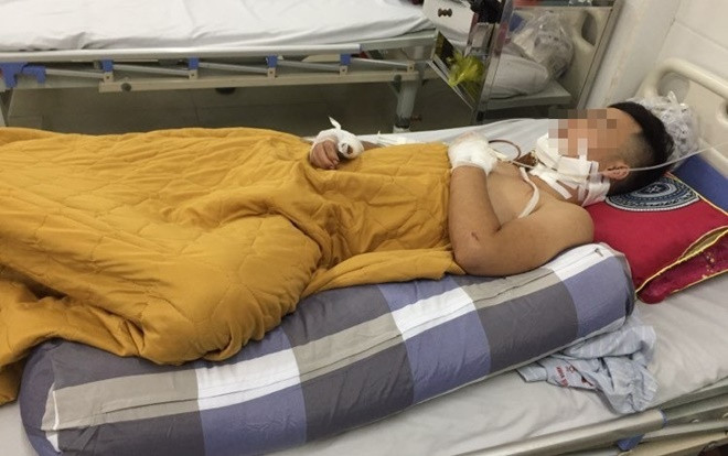 Rút dao kéo đâm bạn nhậu do mâu thuẫn Ảnh 2