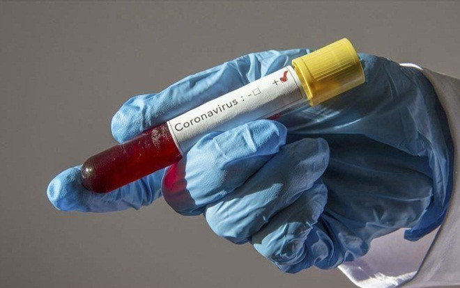 Công bố ca số 46, 47 mắc COVID-19: Nữ tiếp viên Vietnam Airlines và người giúp việc bệnh nhân số 17 Ảnh 2