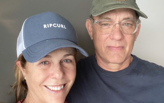 Sau một ngày dương tính với virus Corona, Tom Hanks đã cập nhật tình hình sức khỏe đầu tiên! Ảnh 2