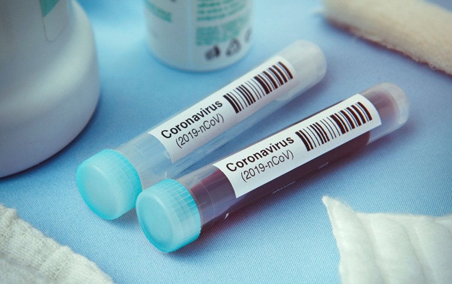 Ca mắc COVID-19 thứ 58, 59, 60 ở Việt Nam là du học sinh, tiếp viên hàng không và khách du lịch Ảnh 2