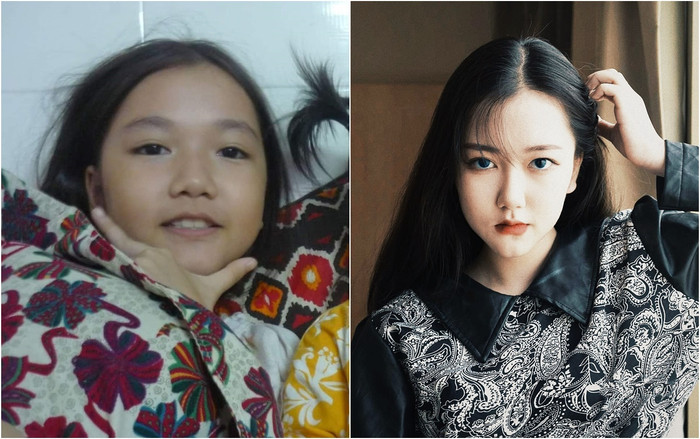 Hotgirl 10X tiết lộ bí quyết trị mụn và cái kết 'dậy thì thành công' khiến dân mạng trầm trồ Ảnh 2