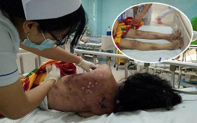 Bắt khẩn cấp chủ quán cà phê chích điện, đánh nhân viên Ảnh 2