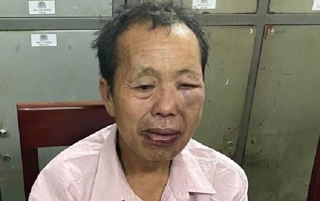 Truy bắt ‘trùm’ ma túy, 2 cảnh sát bị thương Ảnh 2