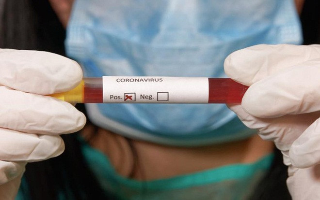 Cập nhật dịch COVID-19: Thêm 21 bệnh nhân đã đủ điều kiện khỏi bệnh, 3 ca nặng phải thở máy Ảnh 2