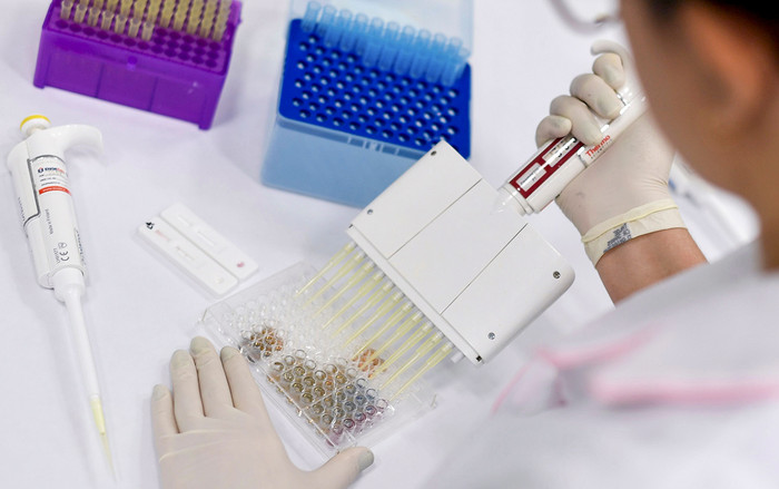 Phát hiện chất ức chế gene trên loài dơi có thể giúp điều chế thuốc đặc trị Covid-19 Ảnh 2