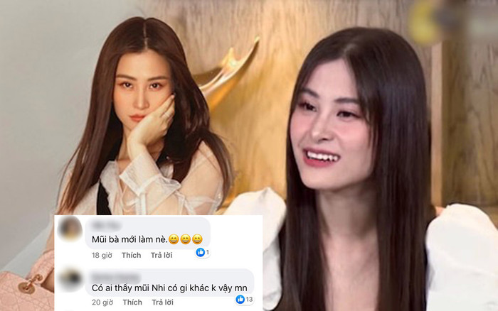 Đông Nhi vướng tin đồn can thiệp 'dao kéo' hậu đám cưới, sống mũi chiếm trọn spotlight Ảnh 2