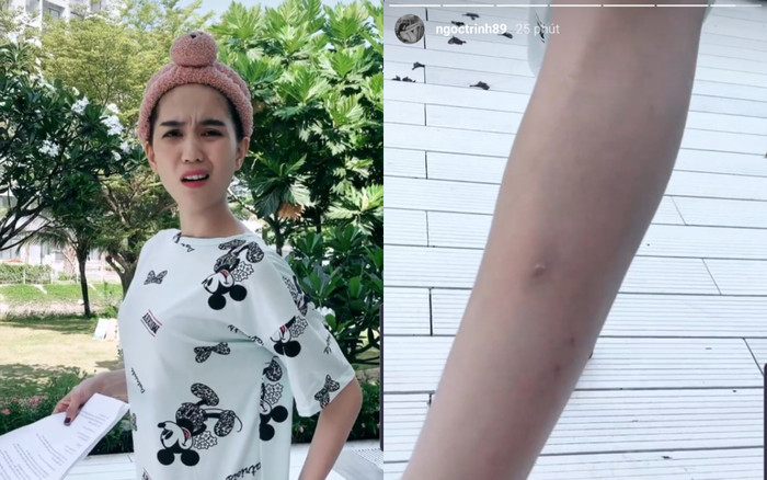 Ngọc Trinh để lộ đôi chân đầy sẹo, than đau… vòng 3 vì diễn tập Ảnh 2
