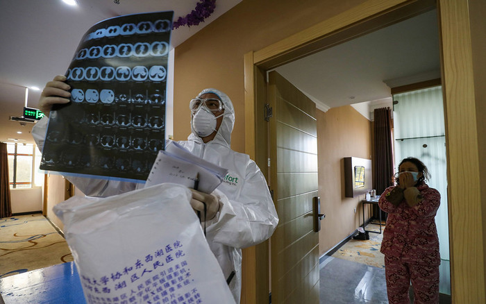 Ảnh chụp CT phát hiện bệnh nhân nữ mắc COVID-19 dù không biểu hiện triệu chứng Ảnh 2