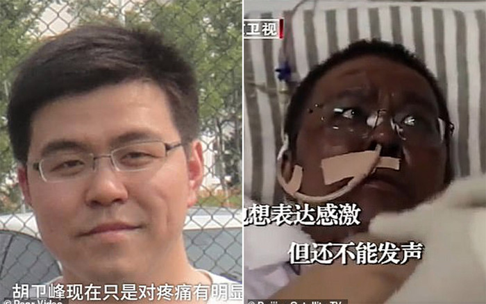 2 bác sĩ kinh ngạc khi thấy da chuyển màu sau khi điều trị COVID-19 Ảnh 2