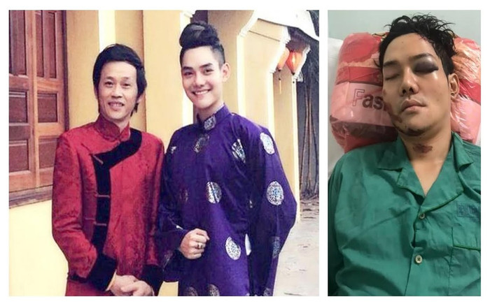 Con trai nuôi nghệ sĩ Hoài Linh phẫu thuật nối xương hàm sau tai nạn nghiêm trọng Ảnh 2