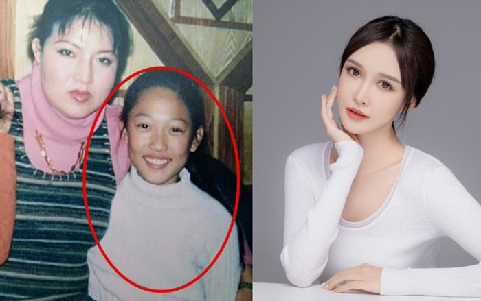 Hotgirl đình đám gây 'sốc' khi tiết lộ được mẹ chi 13 tỷ để phẫu thuật thẩm mỹ 300 lần từ năm 14 tuổi Ảnh 2