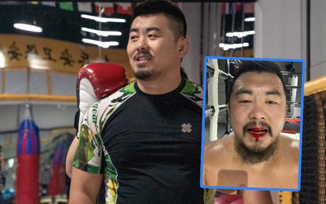 Cao thủ đánh bại hàng loạt võ sư Trung Quốc, Từ Hiểu Đông máu chảy ròng trên miệng Ảnh 2