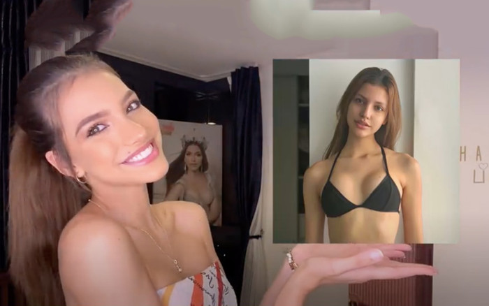 Đương kim Hoa hậu Hòa bình Quốc tế công khai dao kéo, gắn ốc - vít vào miệng đau đớn Ảnh 2