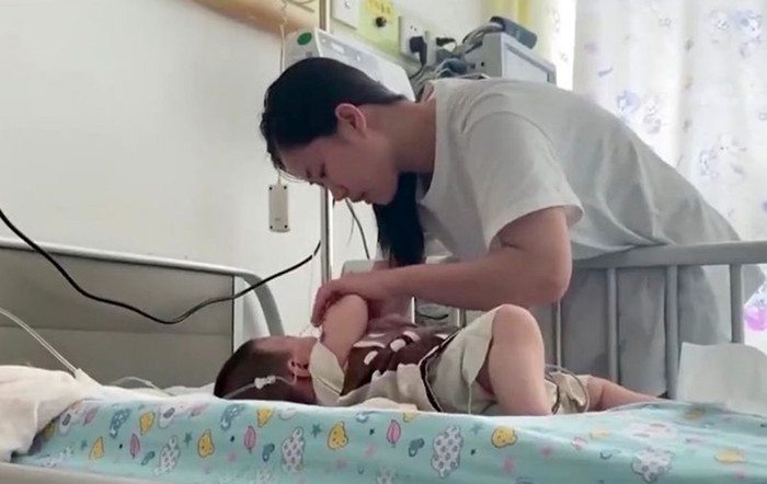 Bé gái 6 tháng tuổi bị chai dầu gội từ tầng cao rơi trúng đến biến dạng đầu Ảnh 2