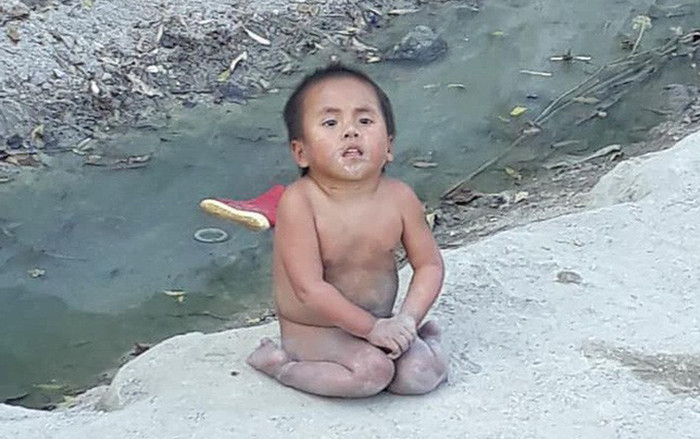 Em bé Mường Lát liệt hai chân co ro giữa giá rét ngày nào ra sao sau 3 năm được nhận nuôi? Ảnh 2