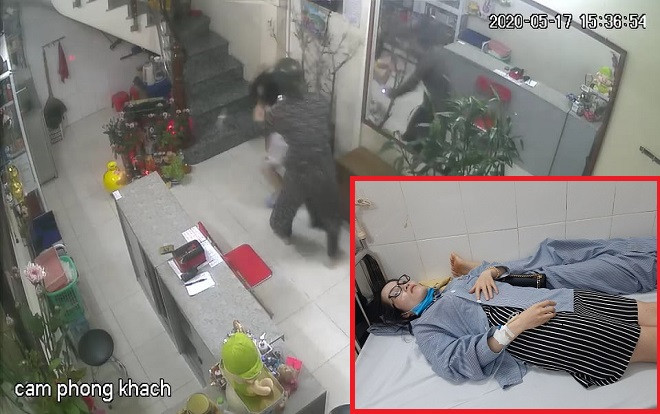 Truy tìm đối tượng hành hung chủ tiệm nail giữa ban ngày phải nhập viện Ảnh 2