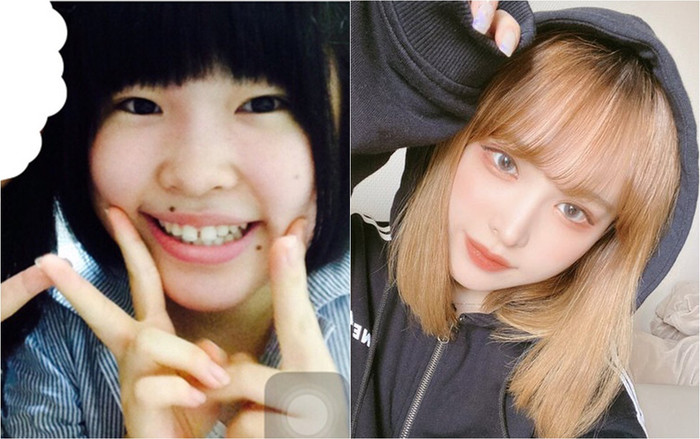 Cô gái trẻ đáp trả sự bội bạc của người yêu cũ bằng màn 'lột xác' ngoạn mục: Giảm cân cấp tốc, trải qua 10 cuộc phẫu thuật thẩm mỹ Ảnh 2