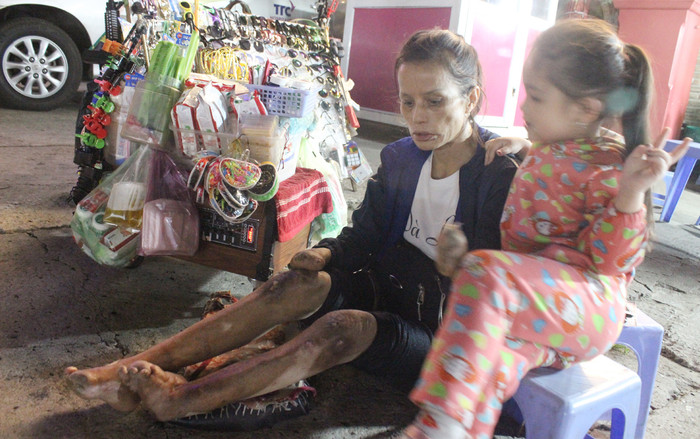 Hoàn cảnh đáng thương của hai bà cháu lang thang ở chợ đêm Đà Lạt: Bao giờ mới hết đớn đau? Ảnh 2