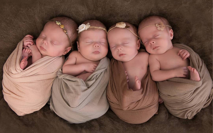 Ngỡ ngàng trước hình ảnh hiện tại của '4 bé gái trong ca sinh tư' thuộc trường hợp hiếm trên thế giới sau 3 năm gây 'bão' cộng đồng mạng Ảnh 2