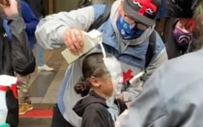 Bé gái khóc thét khi trúng hơi cay của cảnh sát Mỹ trong biểu tình Ảnh 2