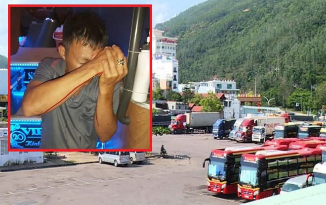 Mâu thuẫn chuyện tranh giành khách, một phụ xe bị bắn trọng thương ở mắt Ảnh 2