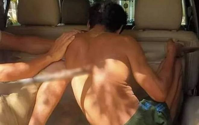 90 phút 'căng não' cứu sống người đàn ông bị chiếc xà beng đâm xuyên người Ảnh 2