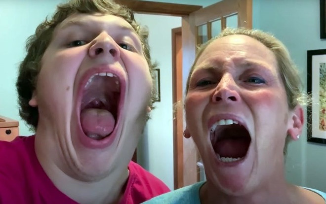 Thiếu niên phá kỷ lục miệng rộng nhất thế giới Ảnh 2