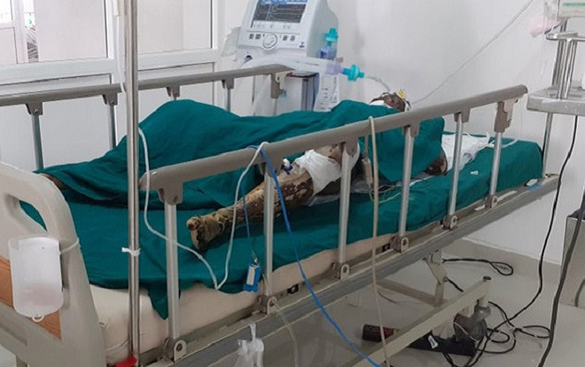 Phóng hỏa đốt nhà trong lúc mâu thuẫn, 2 người tử vong Ảnh 2