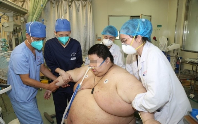 Thanh niên tăng 100 kg sau 5 tháng ở trong nhà vì COVID-19 Ảnh 2