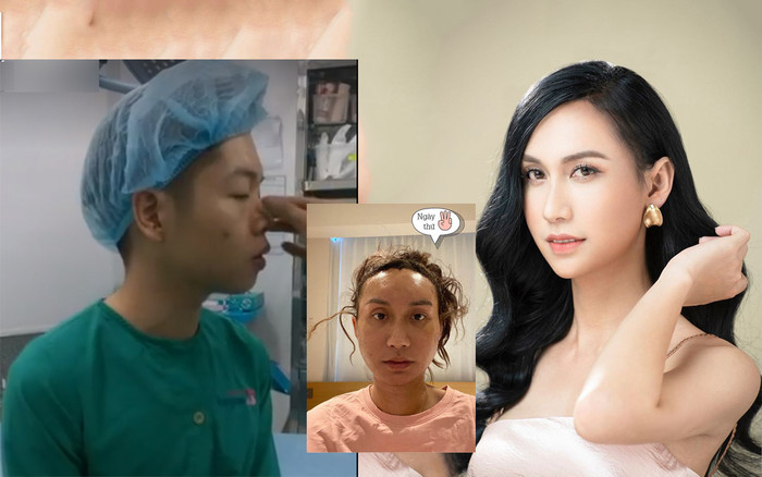 Sao Việt khoe ảnh phẫu thuật thẩm mỹ gây ám ảnh cho fan Ảnh 2