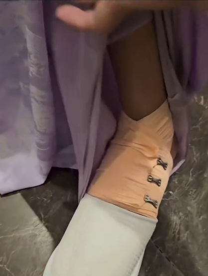 Chân của Miss Grand Thailand 2023 bị chấn thương nặng trong buổi chụp ảnh ngoài trời cùng người đẹp đến từ Ukraina.