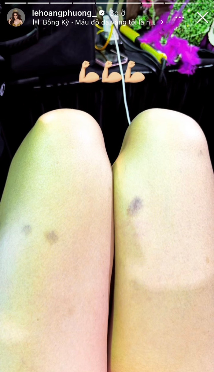 Lê Hoàng Phương gặp khá nhiều khó khăn trước thềm trình diễn trang phục dân tộc. (Ảnh chụp màn hình)