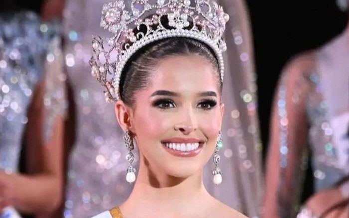 Tân Hoa hậu Miss International 2023 thừa nhận thẩm mỹ Ảnh 2