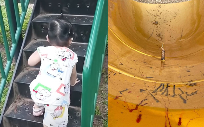 Đưa con đi chơi cầu trượt ở công viên, người mẹ 'tái mặt' phát hiện điều nguy hiểm Ảnh 2
